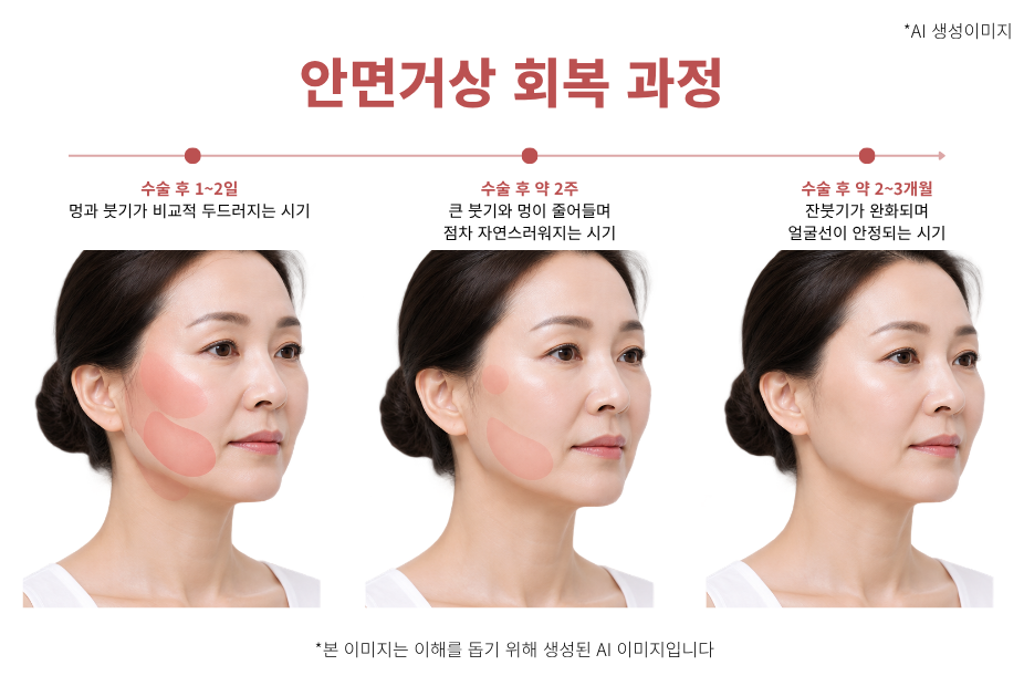 안면거상 수술 후 1~2일, 2주, 2~3개월 회복 단계별 변화