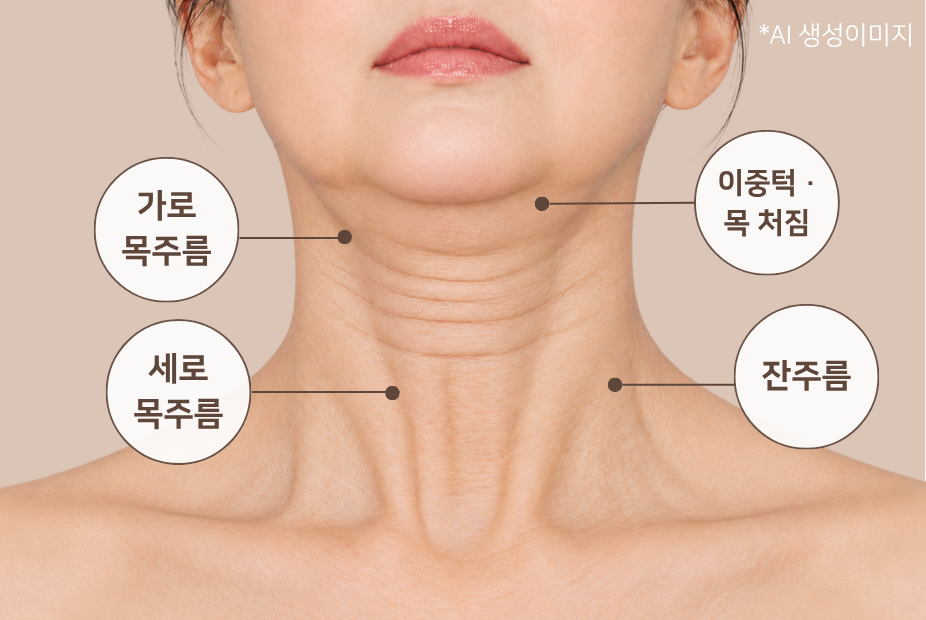 가로 목주름, 세로 목주름, 이중턱·목 처짐, 잔주름 등 목주름 유형별 비교